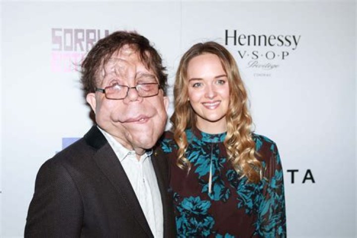 Exploring Adam Pearson's Height: A Unique Perspective