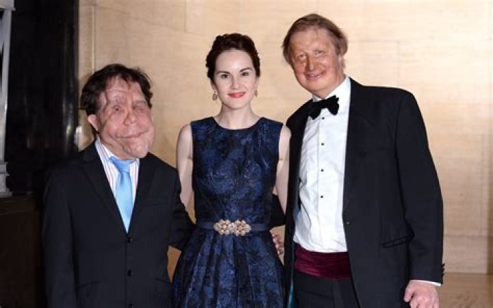 Adam Pearson Wife: A Comprehensive Guide to Her Life, Relationship, and Achievements