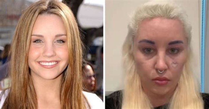 Amanda Bynes Abuse: A Comprehensive Look into the Challenges and Controversies