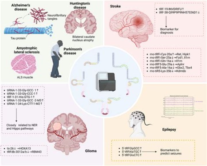Understanding ATPL Brain Disease: Symptoms, Causes, and Treatment