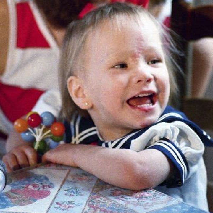 Baby Jessica Injuries: A Comprehensive Analysis and Understanding