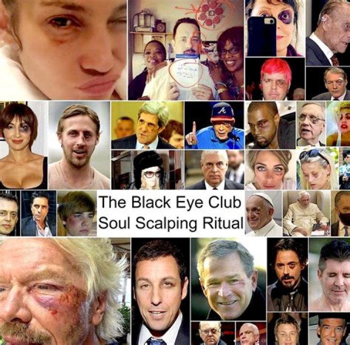 Unveiling the Mysteries Behind the Black Eye Theory