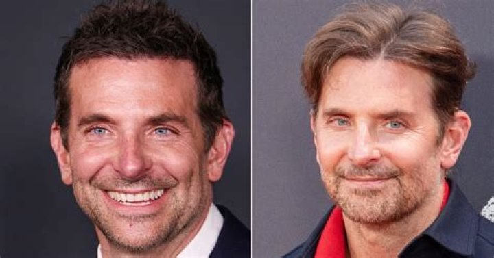Bradley Cooper Face Lift: The Truth Behind the Rumors and Procedures
