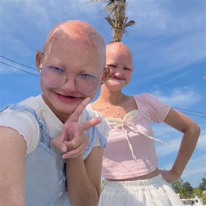 Chanok Twins: What Happened? Unveiling the Truth Behind the Phenomenon