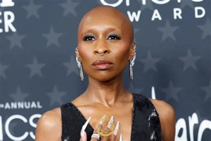 Cynthia Erivo and Her Battle with Alopecia Areata: A Comprehensive Guide