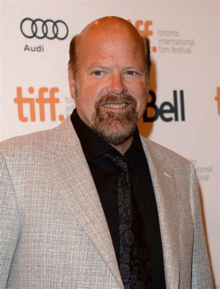 Did Rex Linn Get His Teeth Fixed? The Truth Behind the Smile