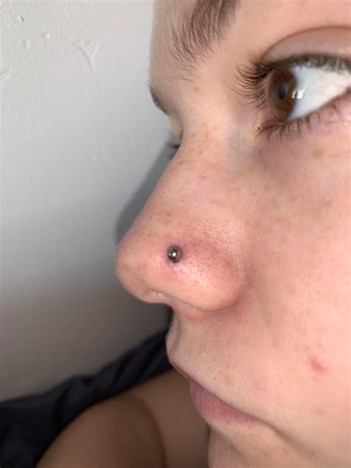 Does a Nose Piercing Close? Understanding the Healing Process and Aftercare