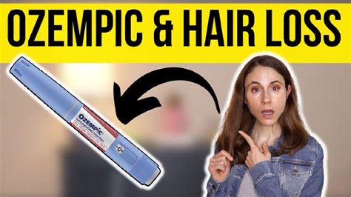Understanding the Relationship Between Ozempic and Hair Loss: A Comprehensive Analysis