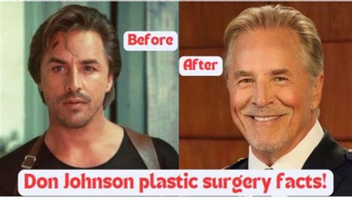 Don Johnson's Evolution: The Truth Behind His Plastic Surgery Journey