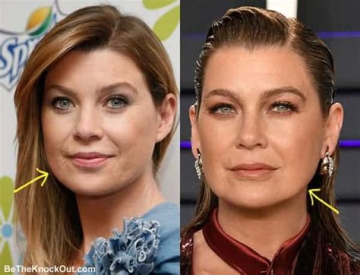 Ellen Pompeo's Unique Scar: A Story of Resilience and Strength