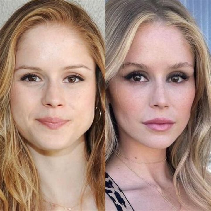 Exploring the Speculations Surrounding Erin Moriarty's Plastic Surgery