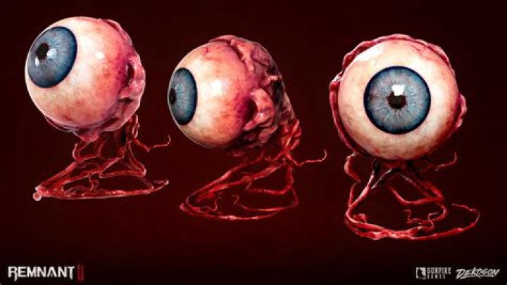 When the Eyeball is Out of Socket: Understanding the Condition