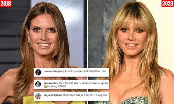Heidi Klum Implants: A Comprehensive Look at the Supermodel's Transformation