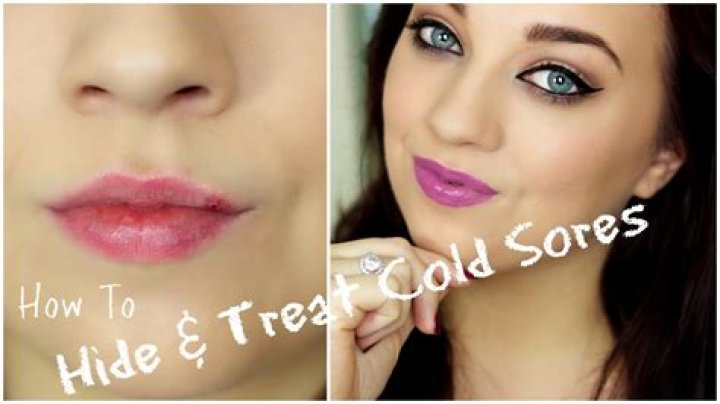 How to Effectively Hide Cold Sores: Tips and Techniques