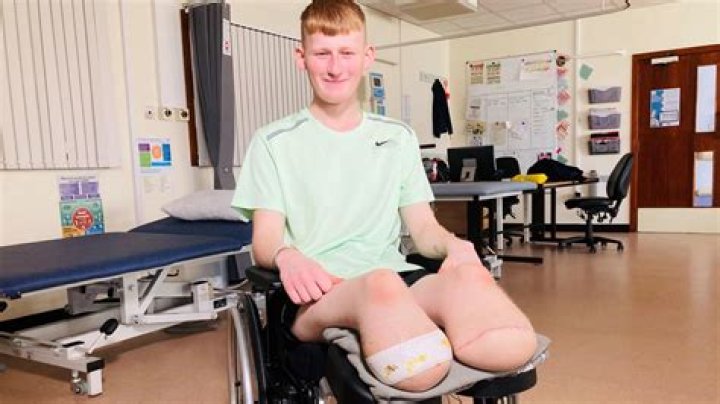 How Did Jersey Jon Lose His Leg? A Detailed and Informative Exploration
