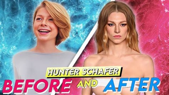 Hunter Schafer Implants: A Comprehensive Guide to Her Journey and Transformation