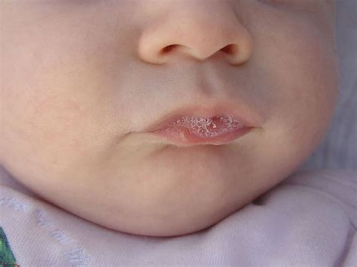 Understanding Infant Lip Quiver: Causes, Concerns, and Care