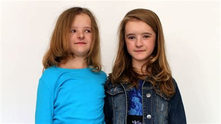 Is Actress Milly Shapiro Disabled?