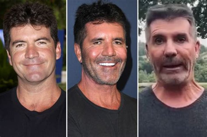 Is Simon Cowell's Son Handicapped? Understanding the Truth Behind the Rumors