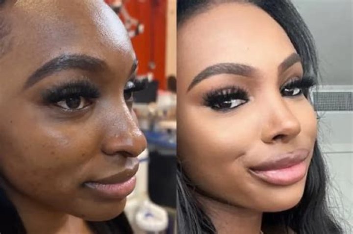 Jana Love Island Nose Job: A Comprehensive Look at Her Transformation
