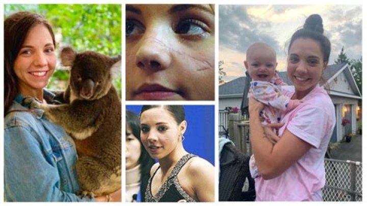 Jessica Dube Injury: A Journey of Resilience Before and After