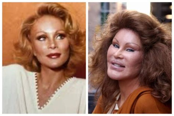 Jocelyn Wildenstein Before Surgeries: The Transformation of a Controversial Icon