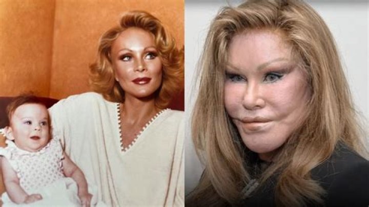 Exploring the Transformation: Jocelyn Wildenstein Before Surgery