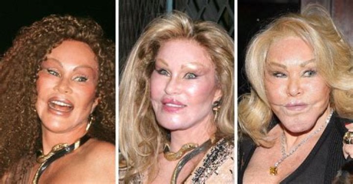 Unveiling Jocelyn Wildenstein Before the Transformation