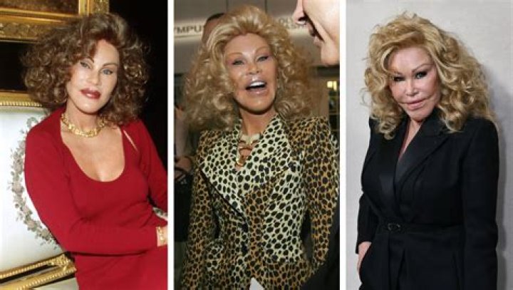 Jocelyn Wildenstein: Unveiling the Early Years