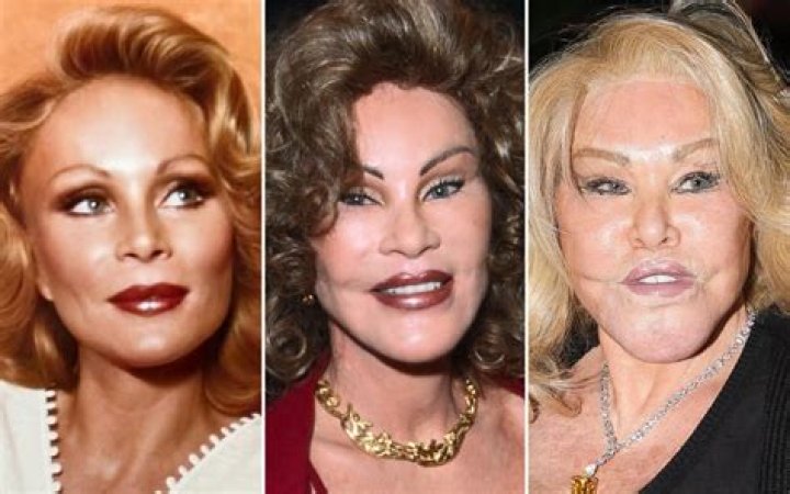 Jocelyn Wildenstein: The Iconic Socialite and Her Transformative Journey