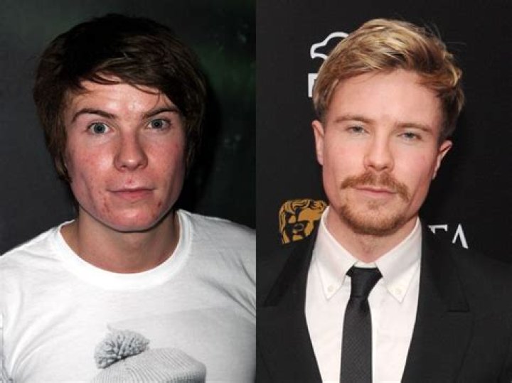 Exploring the Life and Love of Joe Dempsie: Who is His Partner?