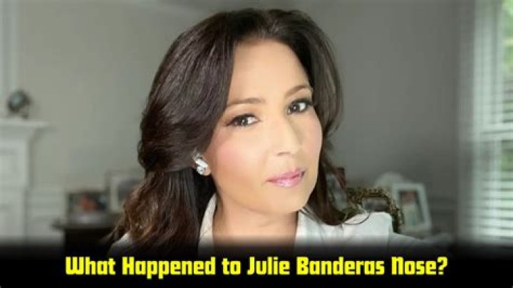 Julie Banderas Injury: A Comprehensive Look at the Incident and Its Impact