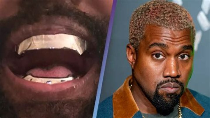 Kanye West Teeth: A Journey Through His Iconic Smile and Dental Transformation