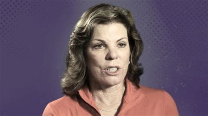 The Ultimate Guide to Kathy Fritz's Face Surgery: Before and After