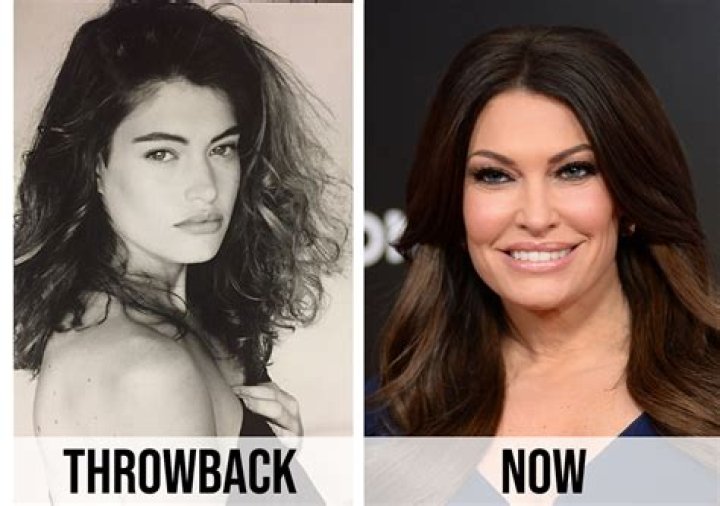 Unveiling the Transformation: Kimberly Guilfoyle Before and After