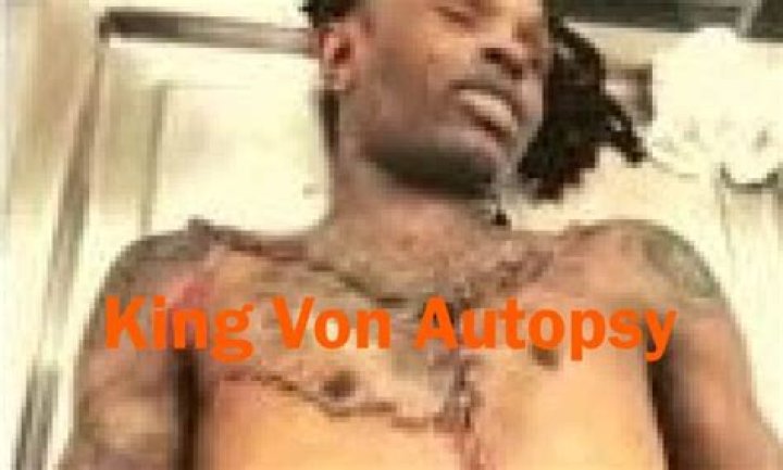 Unveiling the Mystery: King Von Autopsy Pics and Their Impact on Fans