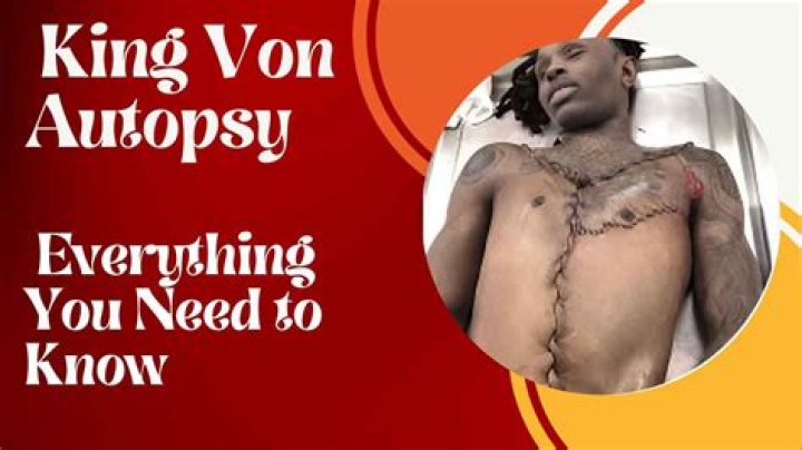 Unveiling the Truth: King Von Autopsy Pictures and Their Impact