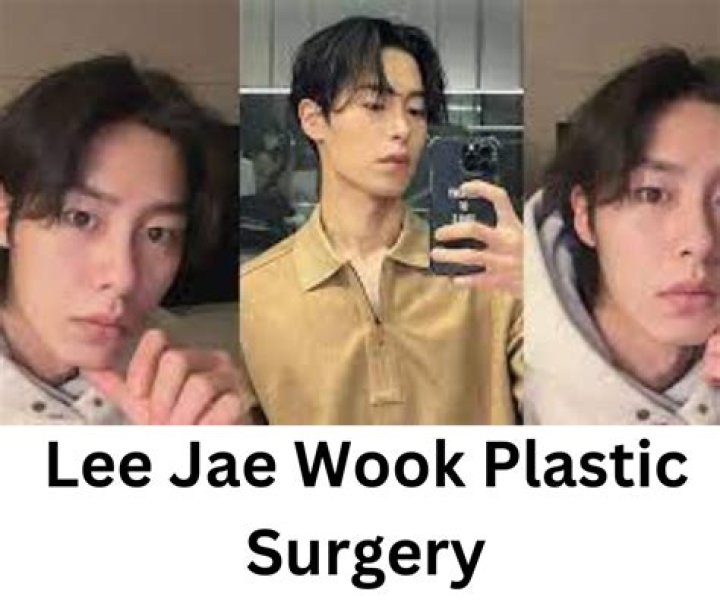 Lee Jae-wook Plastic Surgery: Unveiling the Truth Behind the Transformation