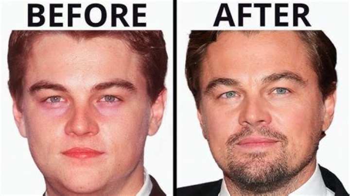 Leonardo DiCaprio Cleft Palate: The Fascinating Truth Behind the Legend