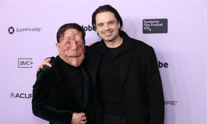 Love Story Adam Pearson and His Dedicated Wife: A Journey of Devotion