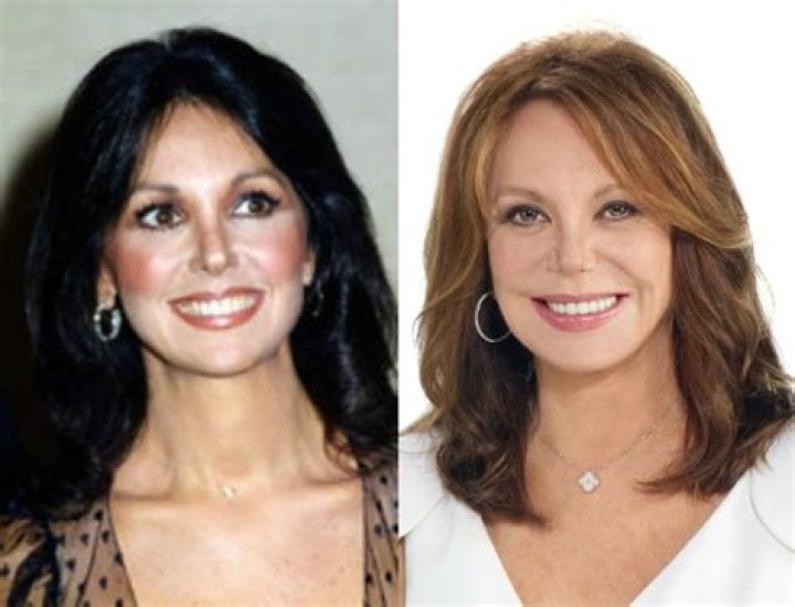 Exploring Marlo Thomas and Her Journey Through Plastic Surgery