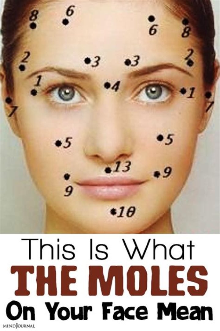 Moles on Face and Their Meanings: Understanding the Significance