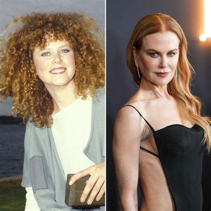 Nicole Kidman: The Evolution Through Plastic Surgery