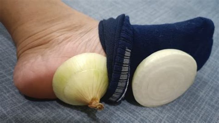 Onions in Socks: The Surprising Health Benefits You Need to Know