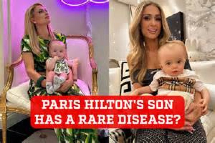 Understanding the Condition of Paris Hilton's Son: A Closer Look