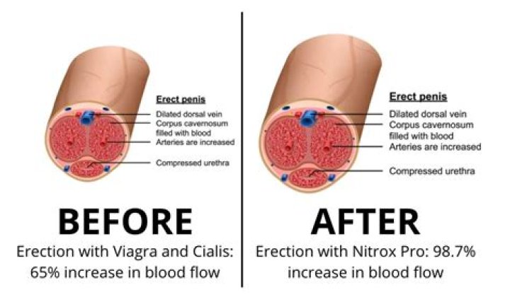 Unveiling the Truth About Penis Salt Teick: A Comprehensive Guide