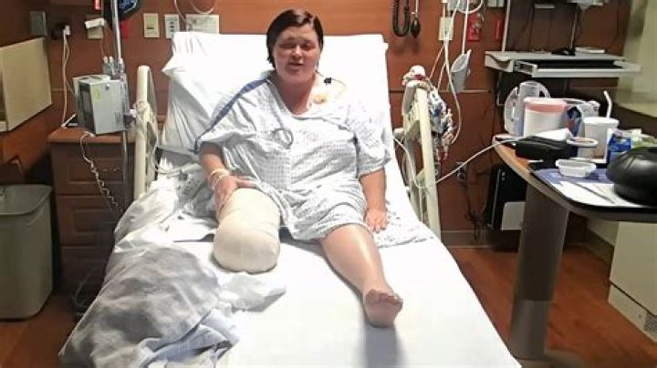 Overcoming Adversity: The Remarkable Journey of Richard Thomas and His Beinamputation