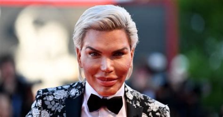Rodrigo Alves: The Journey of Brazil's Most Influential Plastic Surgery Advocate