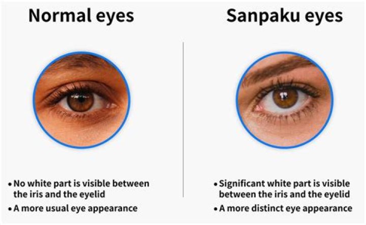 Understanding Sanpaku Eyes: The Intriguing Phenomenon and Its Cultural Significance