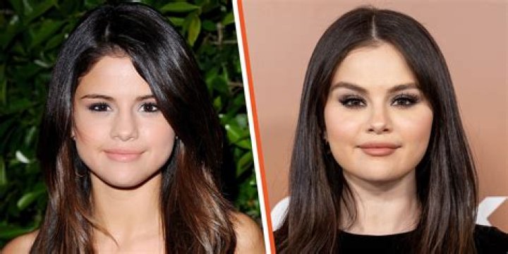 Selena Gomez Breast: A Comprehensive Look at Her Journey and Empowerment